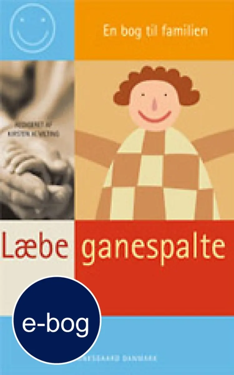 Læbe-ganespalte af Bente Jensen