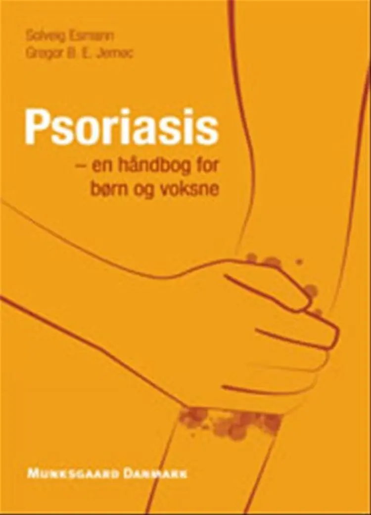 Psoriasis af Solveig Esmann