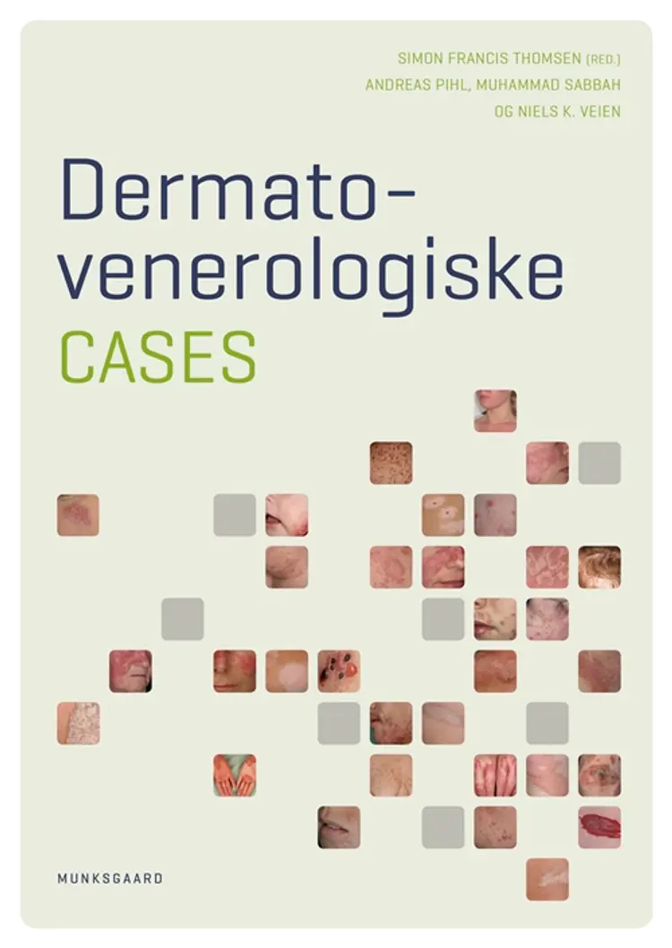 Dermato- venerologiske cases af Andreas Pihl