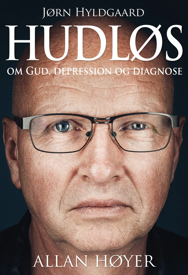 Hudløs af Allan Høyer