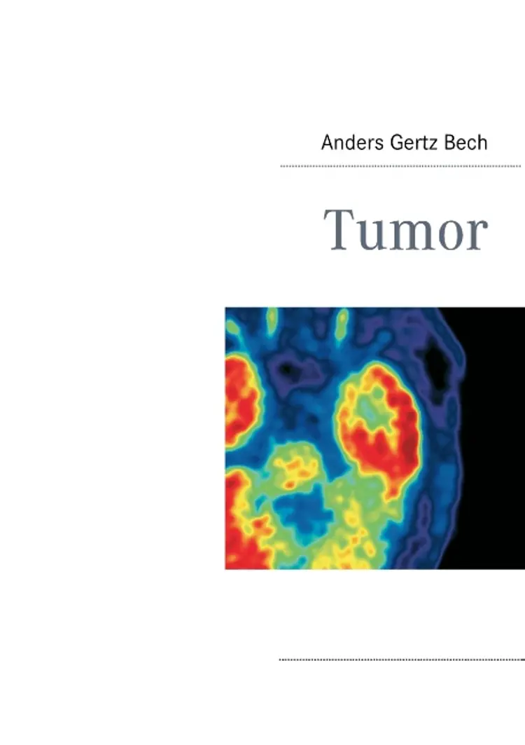 Tumor af Bech
