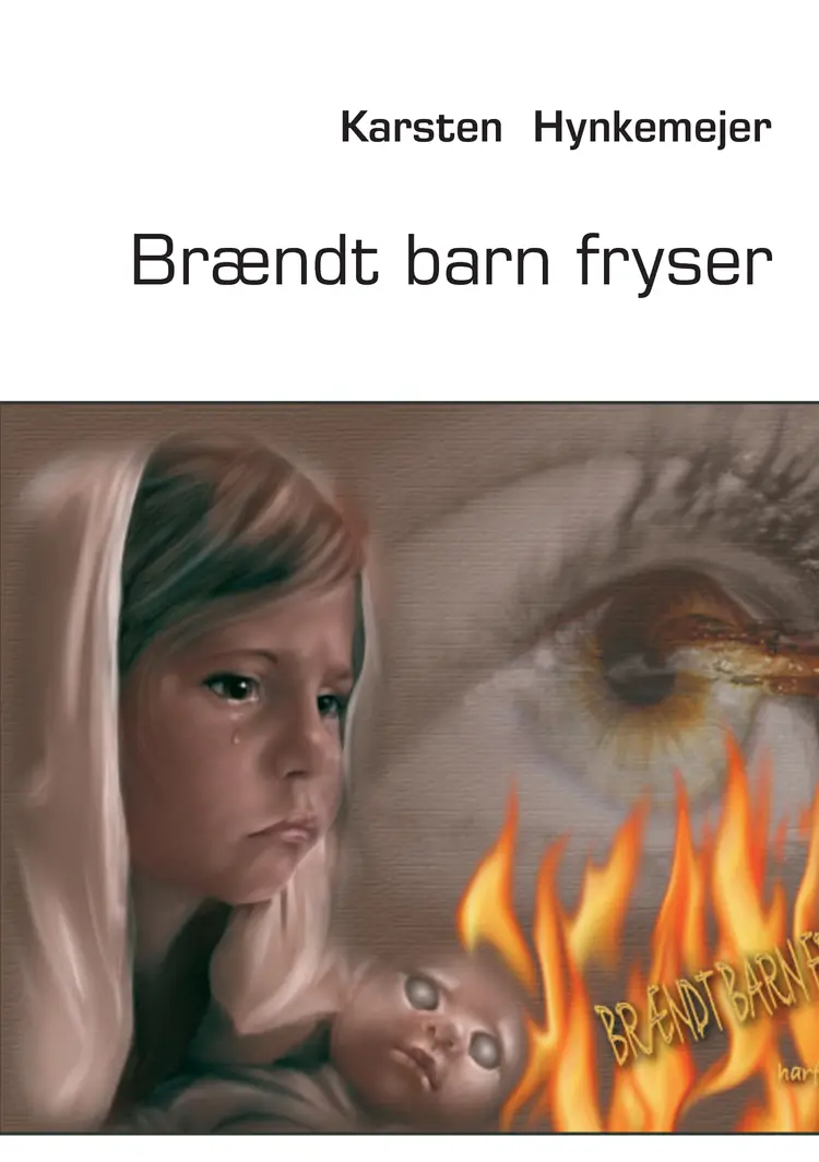 Brændt barn fryser af Karsten Hynkemejer