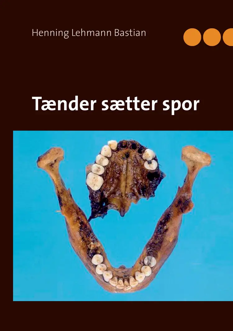 Tænder sætter spor af Henning Lehmann Bastian