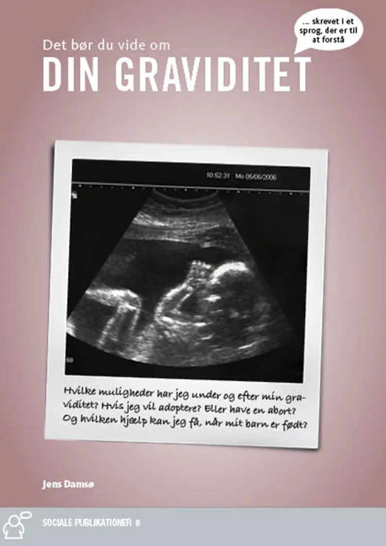 Din graviditet af Jens Damsø