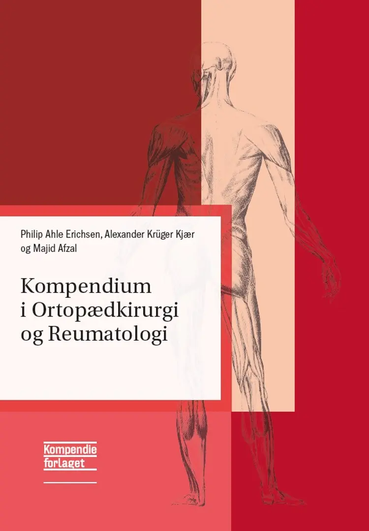Kompendium i Ortopædkirurgi og Reumatologi af Philip Ahle Erichsen