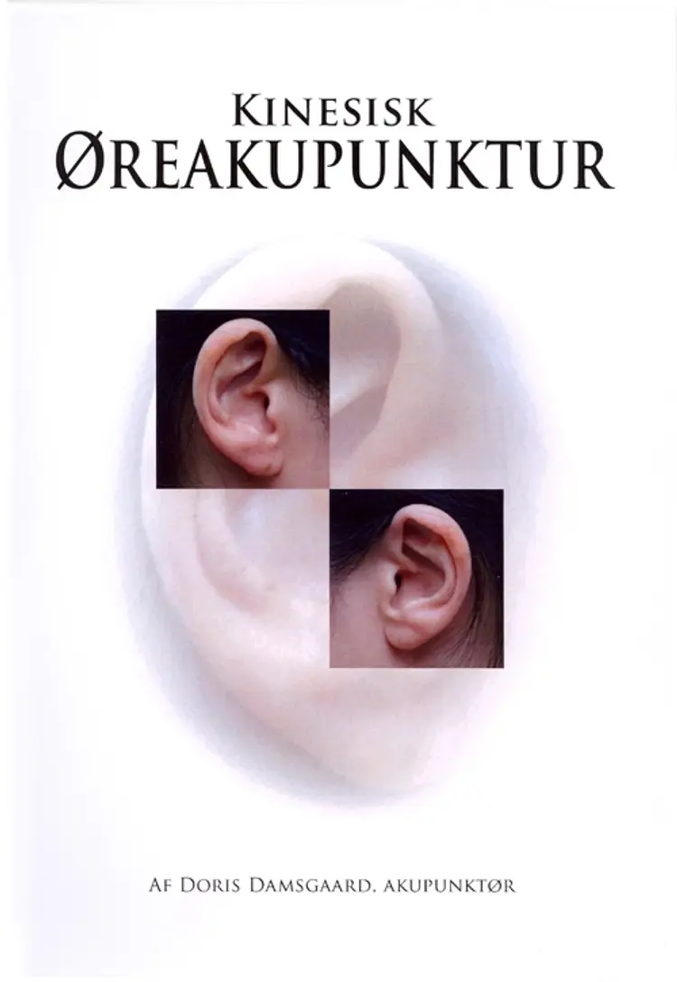 Kinesisk øreakupunktur af Doris Damsgaard