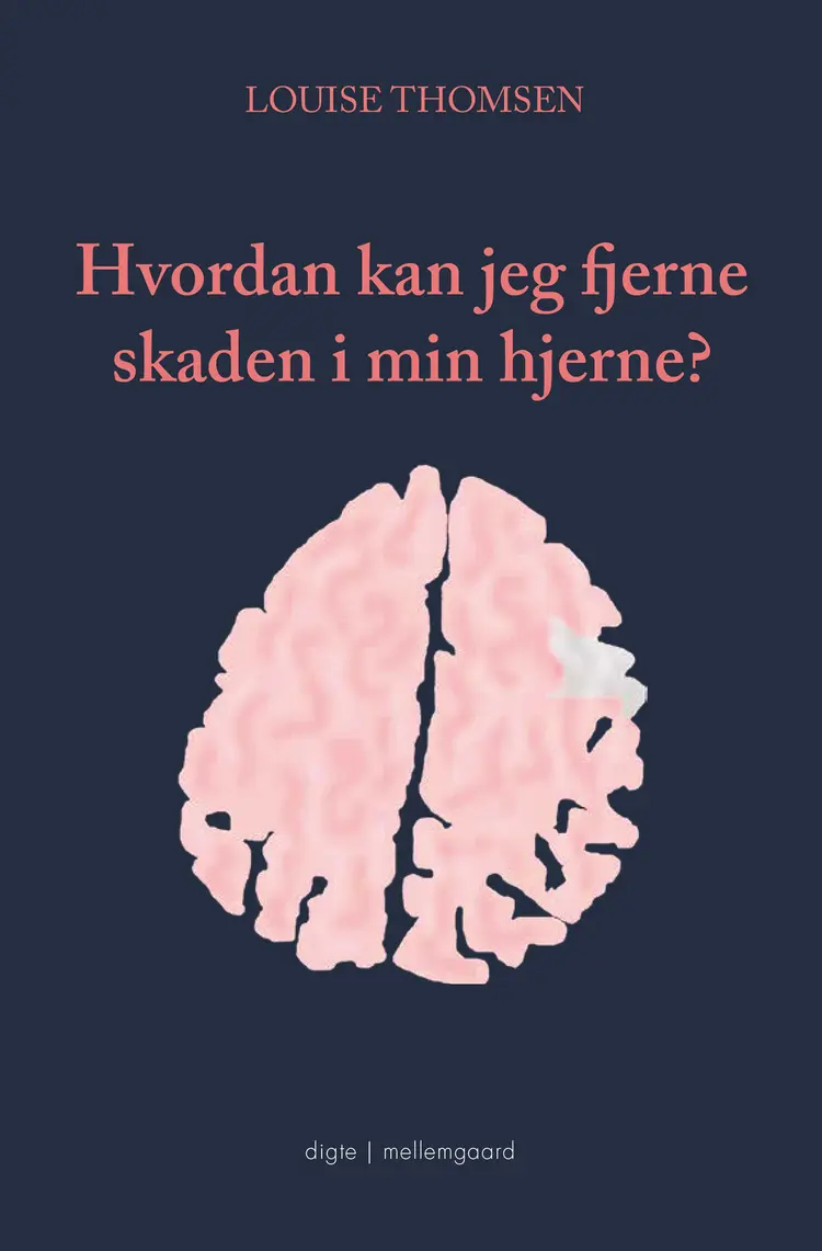 Hvordan kan jeg fjerne skaden i min hjerne? af Louise Thomsen