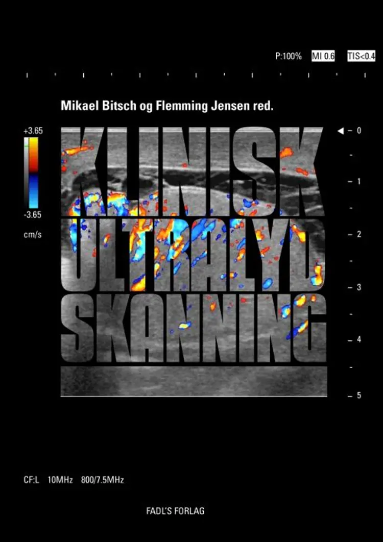 Klinisk ultralydskanning af Mikael Bitsch