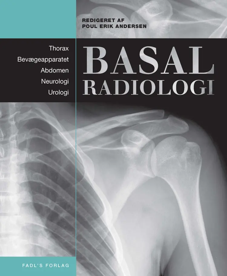 Basal radiologi af Poul Erik Andersen