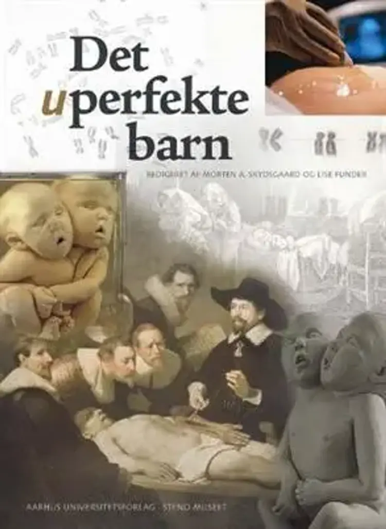 Det uperfekte barn af Lise Funder