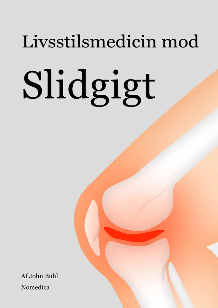 Livsstilsmedicin mod slidgigt af John Buhl