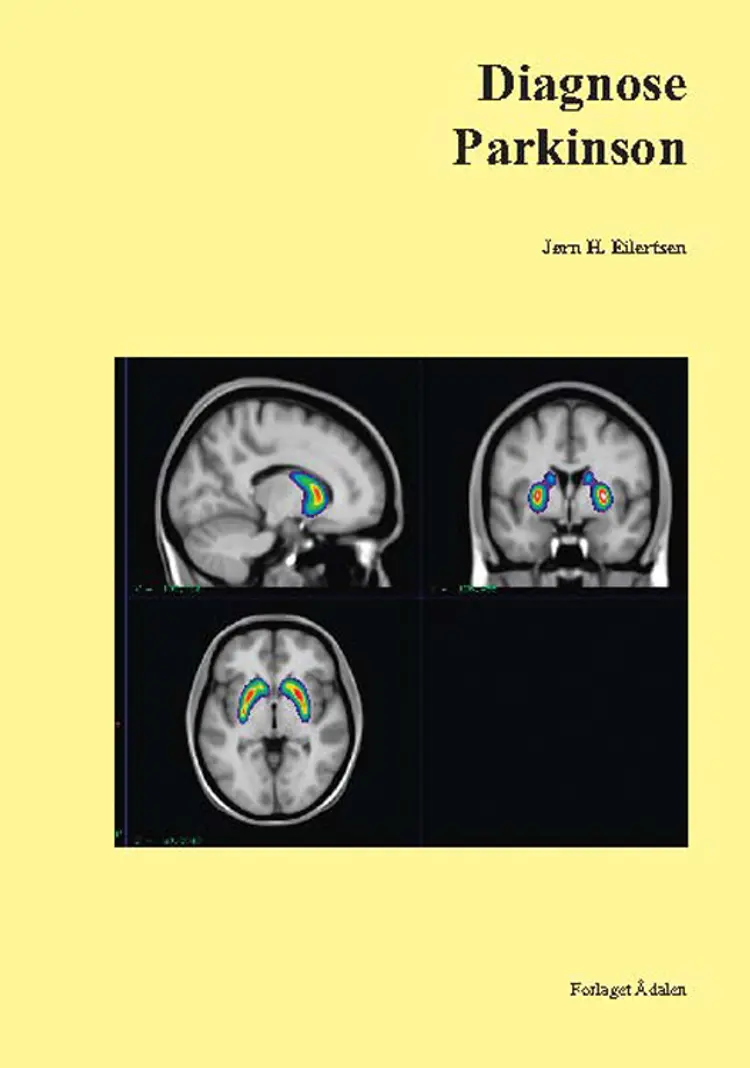 Diagnose Parkinson af Jørn H. Eilertsen