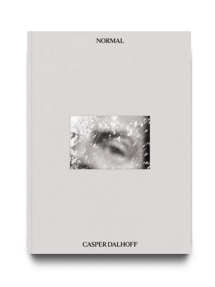 Normal af Casper Dalhoff