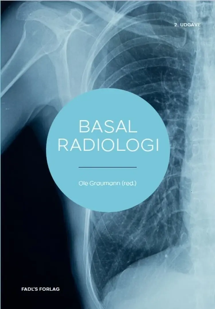 Basal radiologi 2. udg. af Anne Grethe Jurik