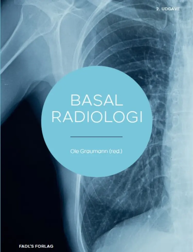 Basal radiologi af Ole Graumann (red.)