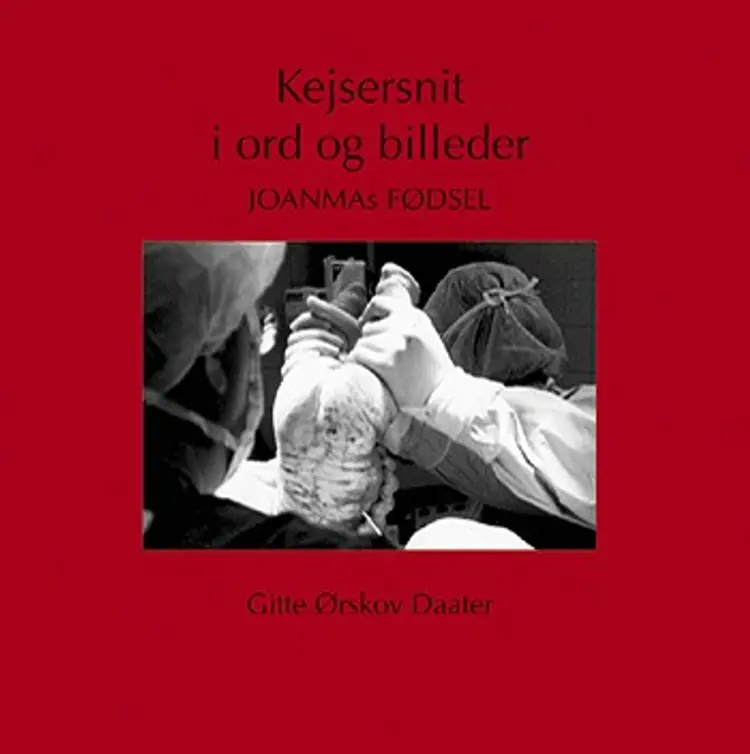 Kejsersnit i ord og billeder af Gitte Ørskov Daater