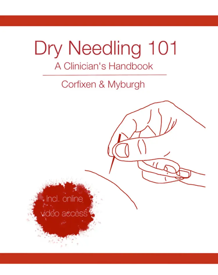 Dry needling 101 af Kim Corfixen