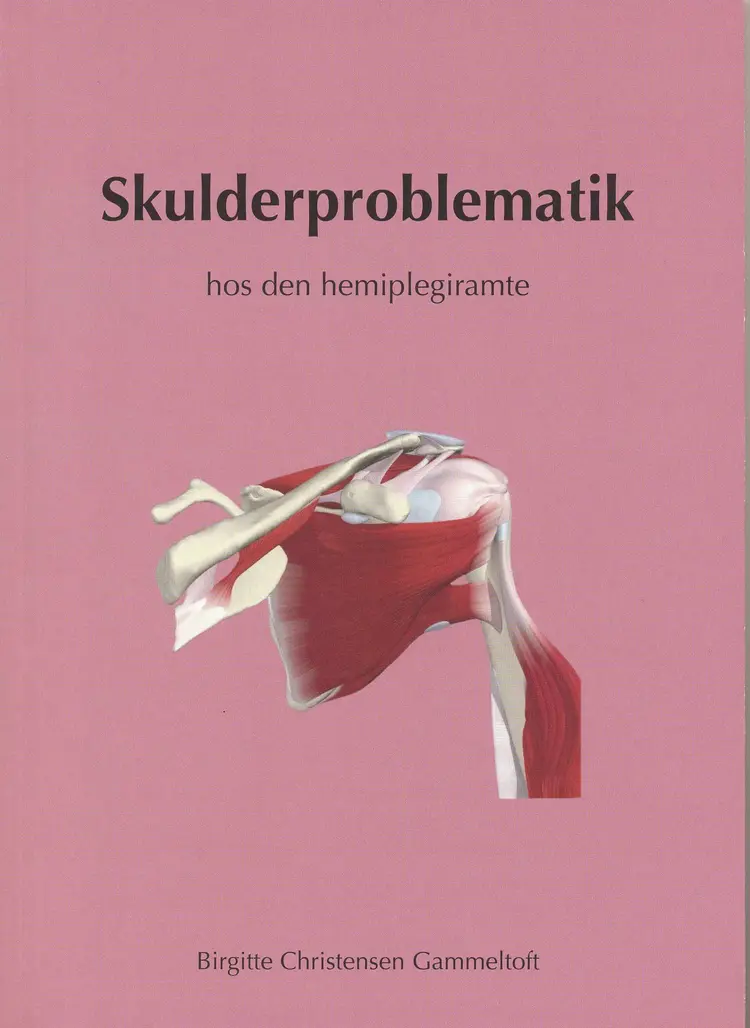 Skulderproblematik og skulderrehabilitering hos den hemiplegiramte af Birgitte Christensen Gammeltoft