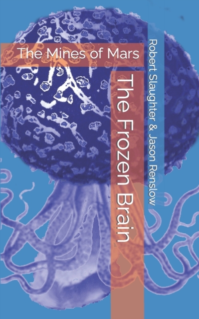 The Frozen Brain