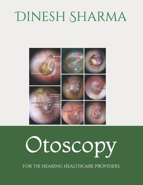 Otoscopy