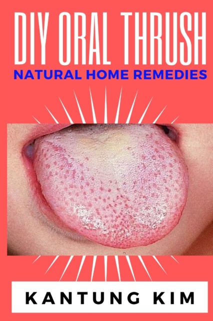 DIY Oral Thrush Natural Home Remedies