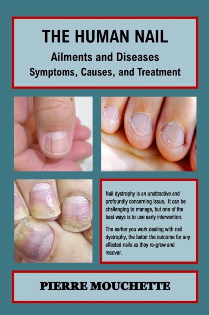THE HUMAN NAIL - Ailments and Diseases