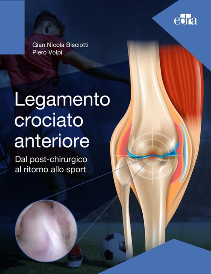 Legamento crociato anteriore. Dal post-chirurgico al ritorno allo sport di Gian Nicola BisciottiPiero Volpi