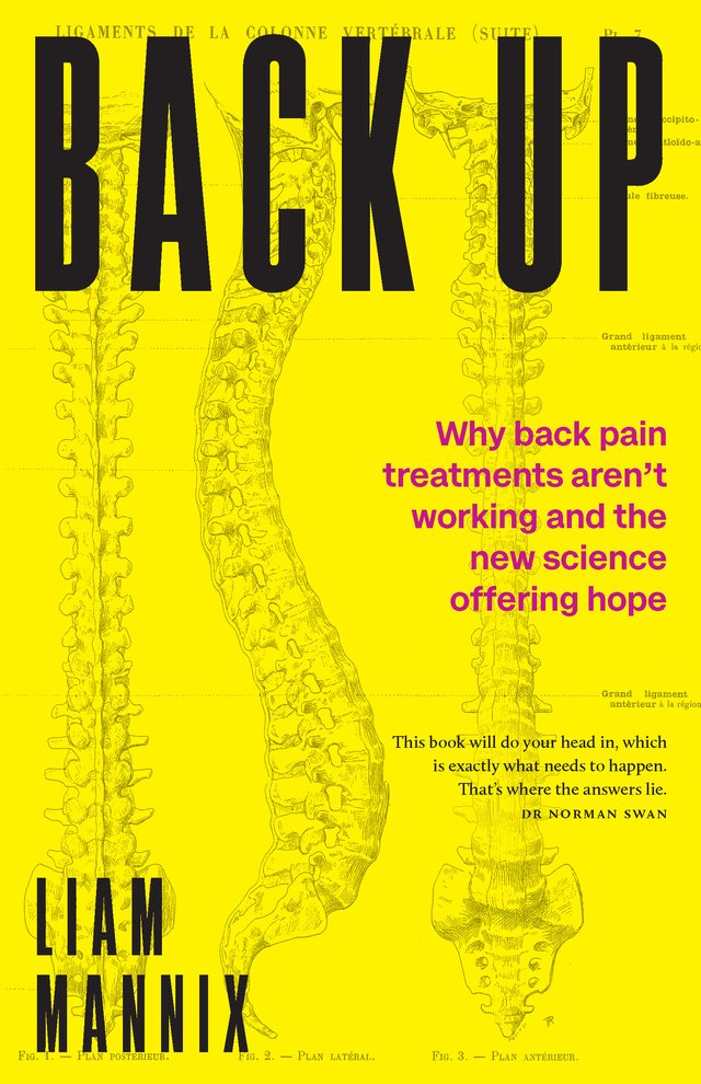 Back Up Back Up