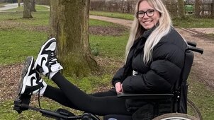 Hátrahajló lábai miatt vannak fájdalmai a 21 éves lánynak: csak egy megoldás van