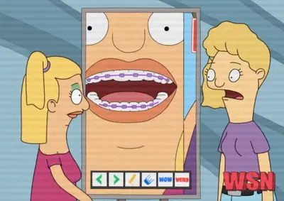 Braces