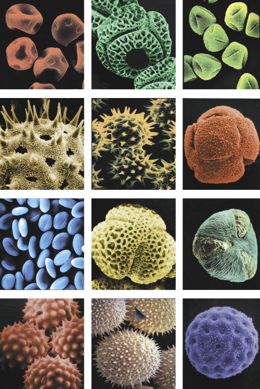 Pollen under microscope