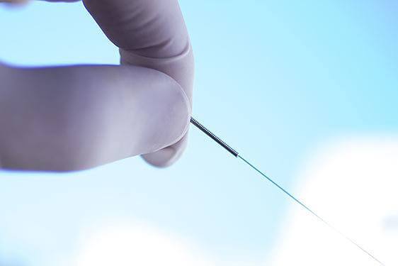 Acupuncture traitement trigger points