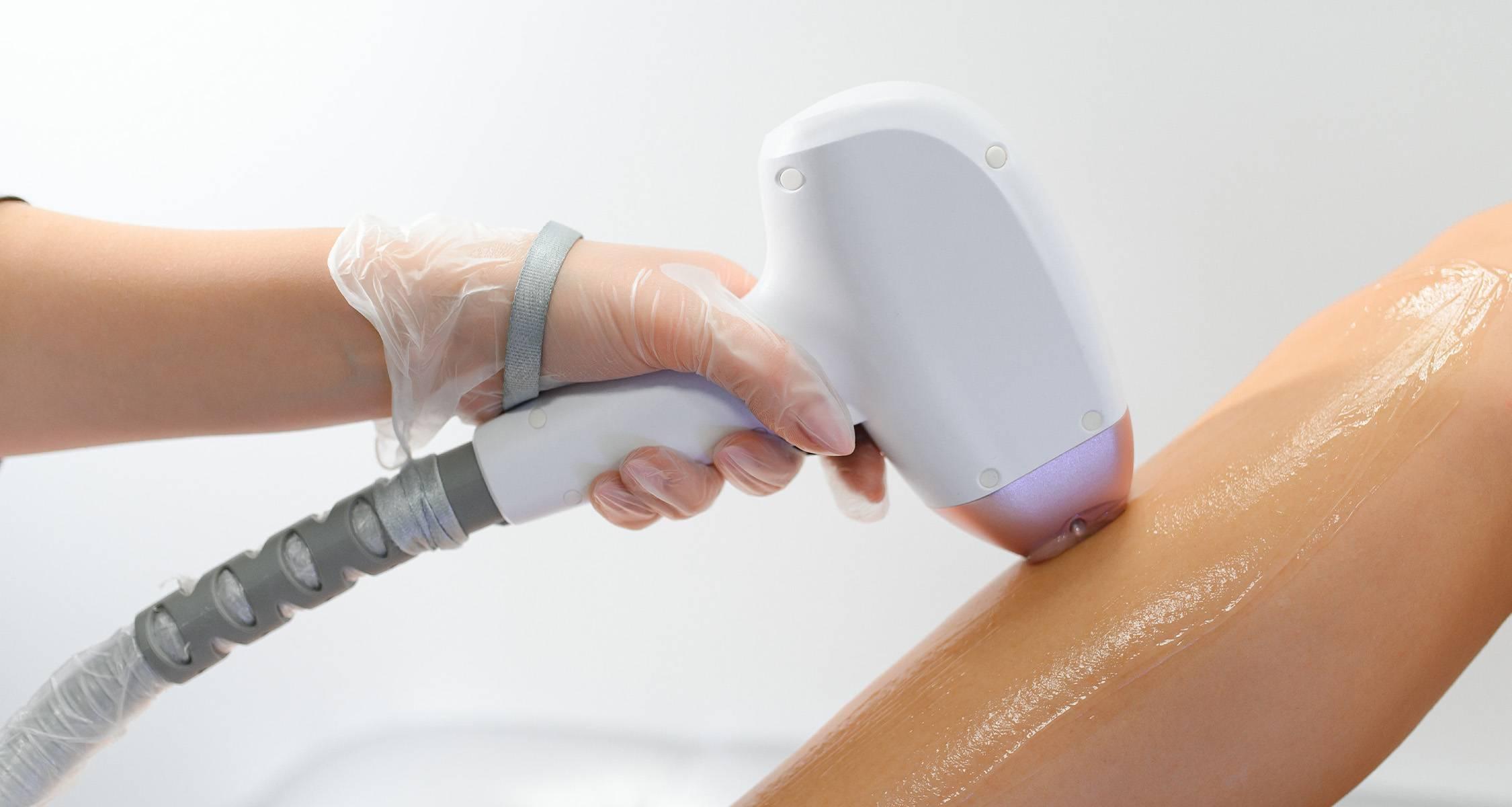 Voucher for diode laser hair removal