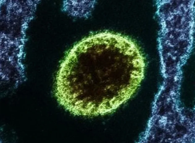 Vírus isolado Nipah observado em laboratório