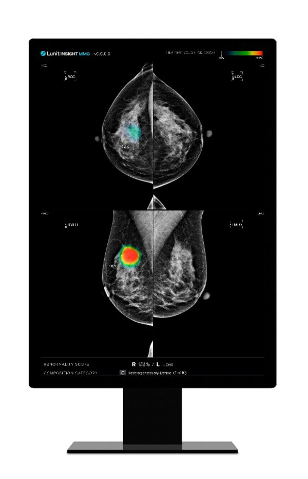 Lunit的AI加強乳房攝影分析解決方案'Lunit INSIGHT MMG'