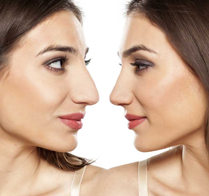 Oral  Maxillofacial Surgeon in Irvine CA
