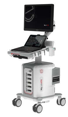 Sistem ultrasound baru Esaote MyLab(TM)A70