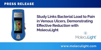 Study Links Bacterial Load to Pain in Venous Ulcers, Demonstrating Effective Reduction with MolecuLight Study Links Bacterial Load to Pain in Venous Ulcers, Demonstrating Effective Reduction with MolecuLight