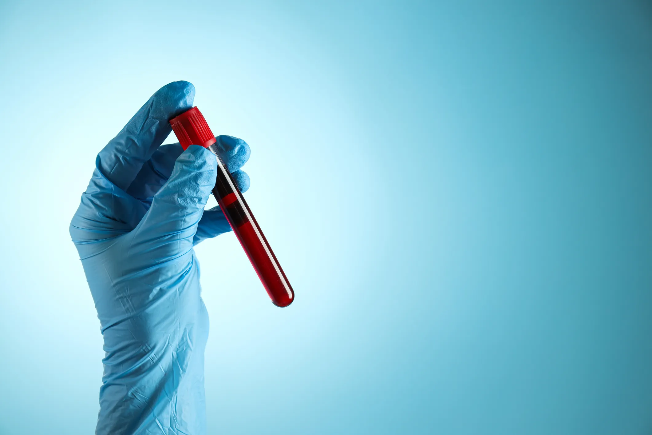 A Blood Test Can Now Spot Alzheimer’s at 40 — So Why Won’t Doctors Let You Take One?