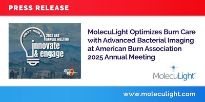 MolecuLight Optimizes Burn Care with Advanced Bacterial Imaging at the American Burn Association 2025 Annual Meeting MolecuLight Optimizes Burn Care with Advanced Bacterial Imaging at the American Burn Association 2025 Annual Meeting