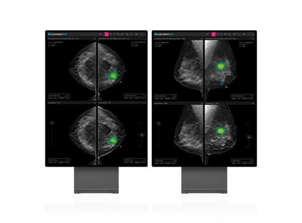 Lunit's AI-powered 3D Breast Tomosynthesis analysis solution, Lunit INSIGHT DBT