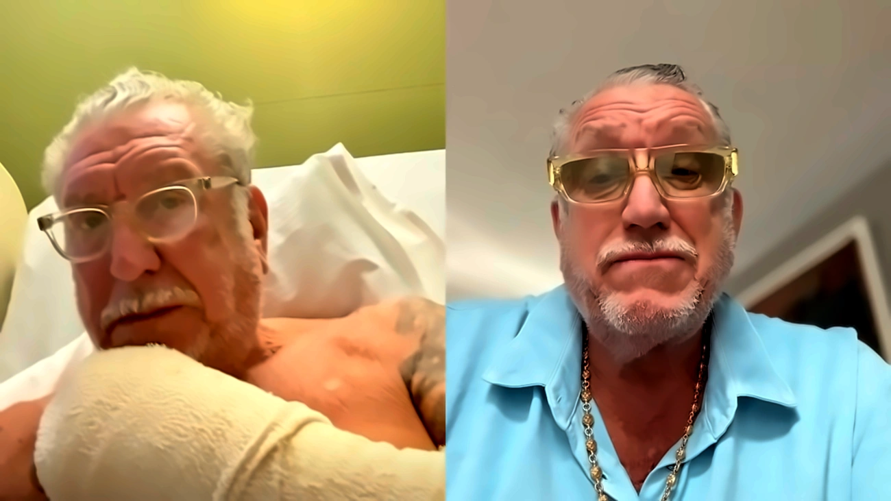 Veja lesão de músico do Sex Pistols que fez banda cancelar show no Brasil