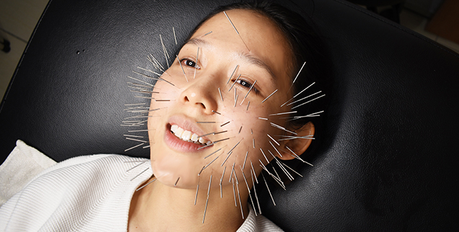 Review: Facial acupuncture, face alignment and gua sha — is it worth the pain?