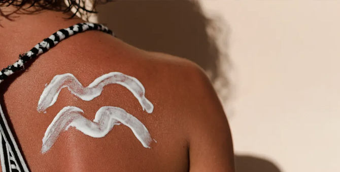 How to treat a sunburn: Dos and don’ts to soothe your skin