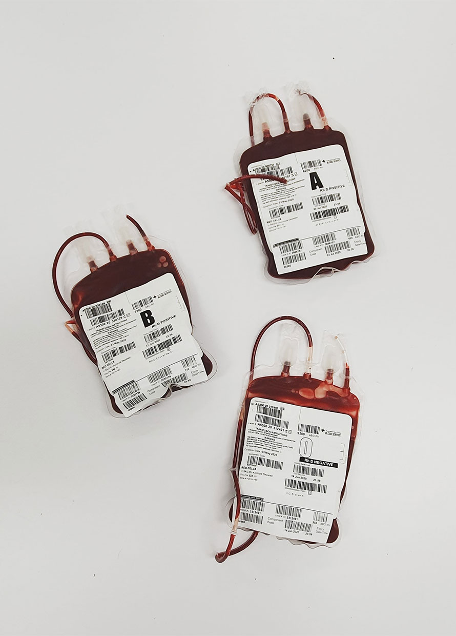 Blood donation: A guide on what to do before, during and after the process