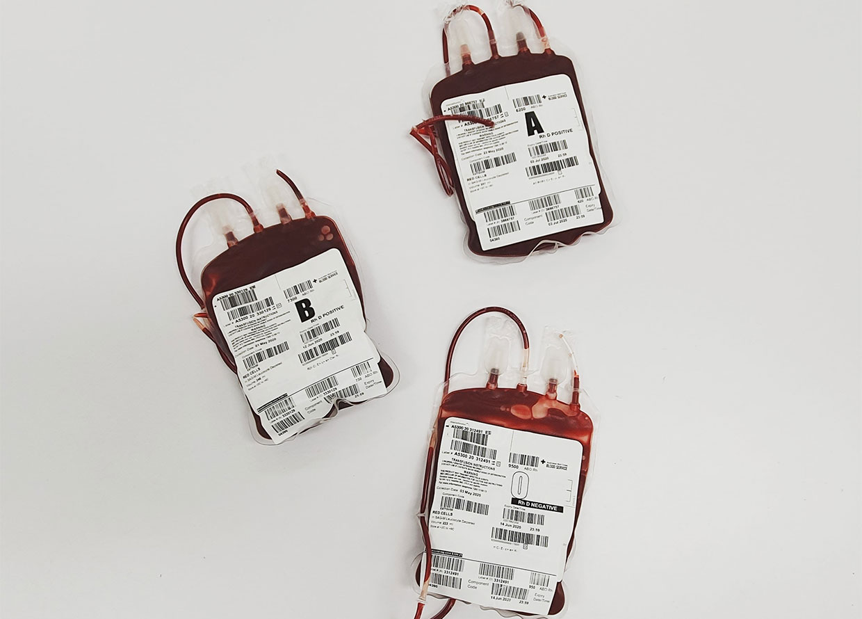 Blood donation: A guide on what to do before, during and after the process