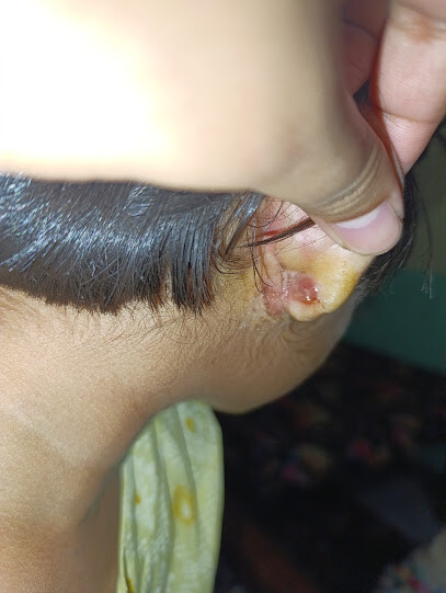EarStudex