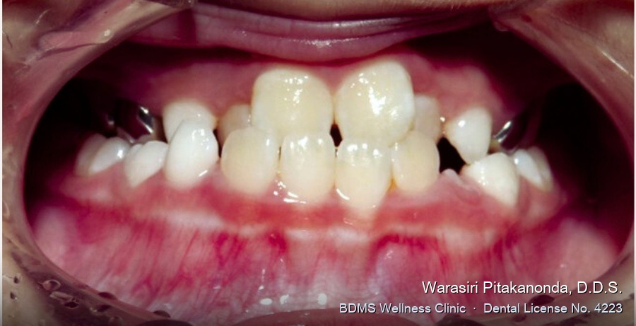Case 04 before