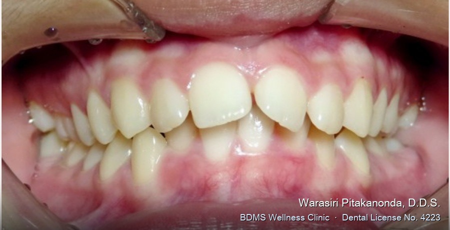 Case 07 before