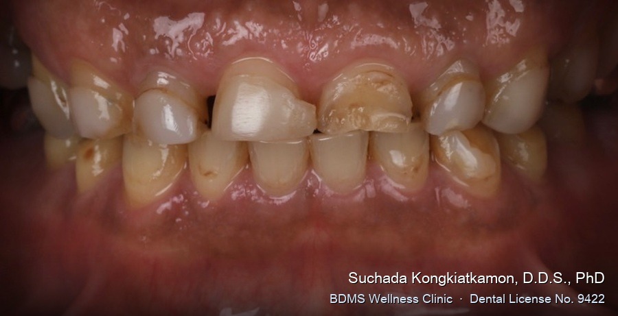 Case 01 before